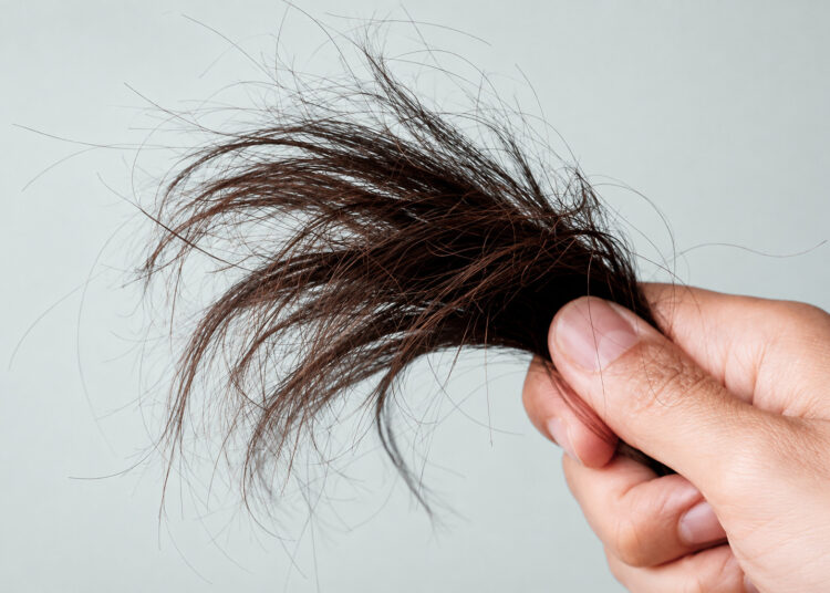 Seu cabelo também envelhece. Ed. 641.